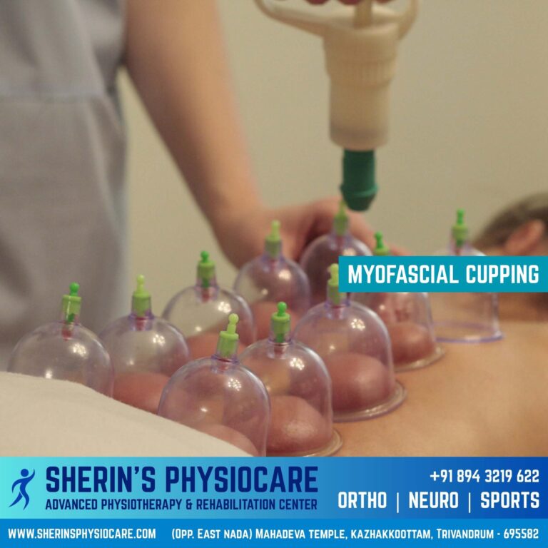 Myofascial cupping therapy in Trivandrum